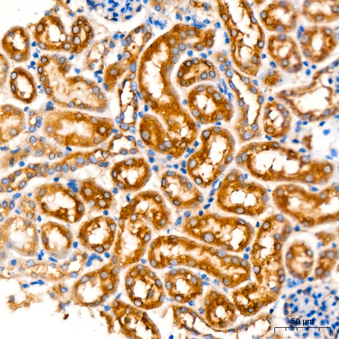 ATG3/APG3 Antibody (5D2W0)