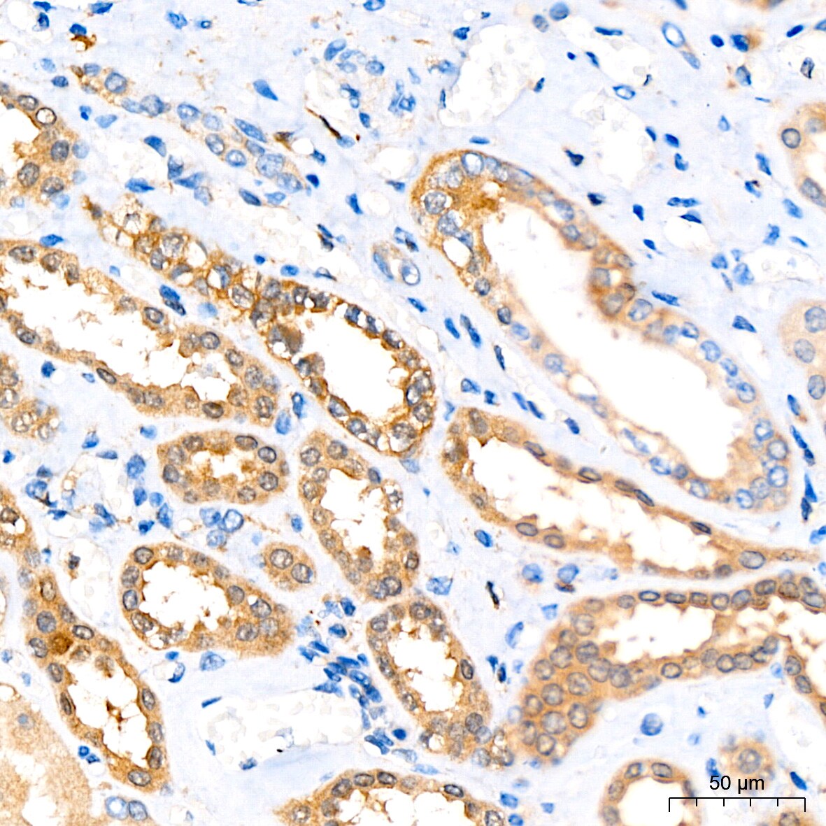 ATG3/APG3 Antibody (5D2W0)