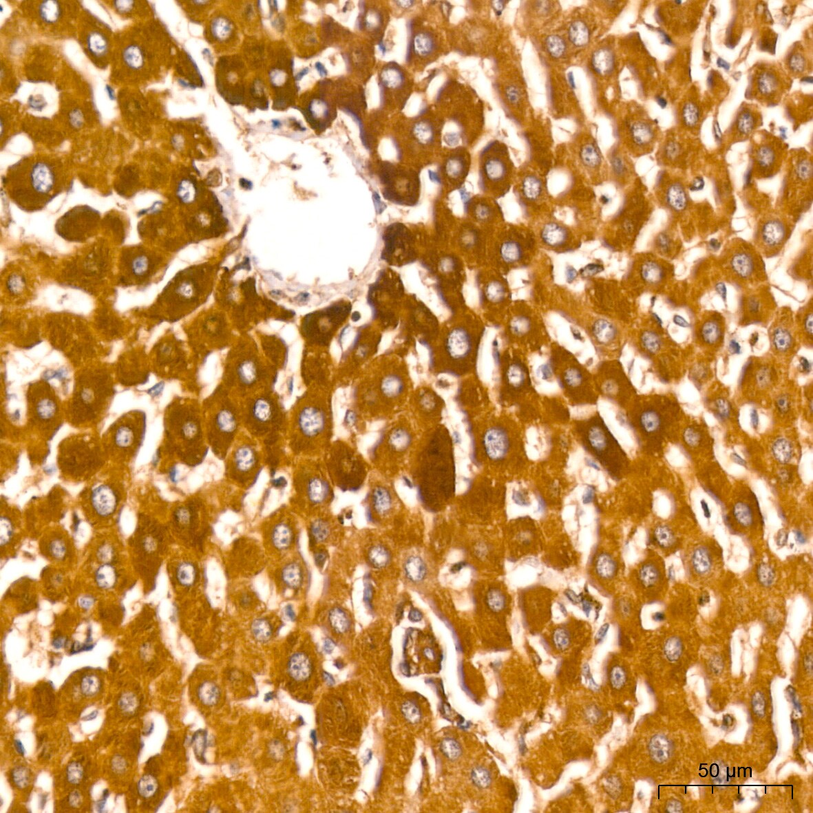 ATG3/APG3 Antibody (5D2W0)