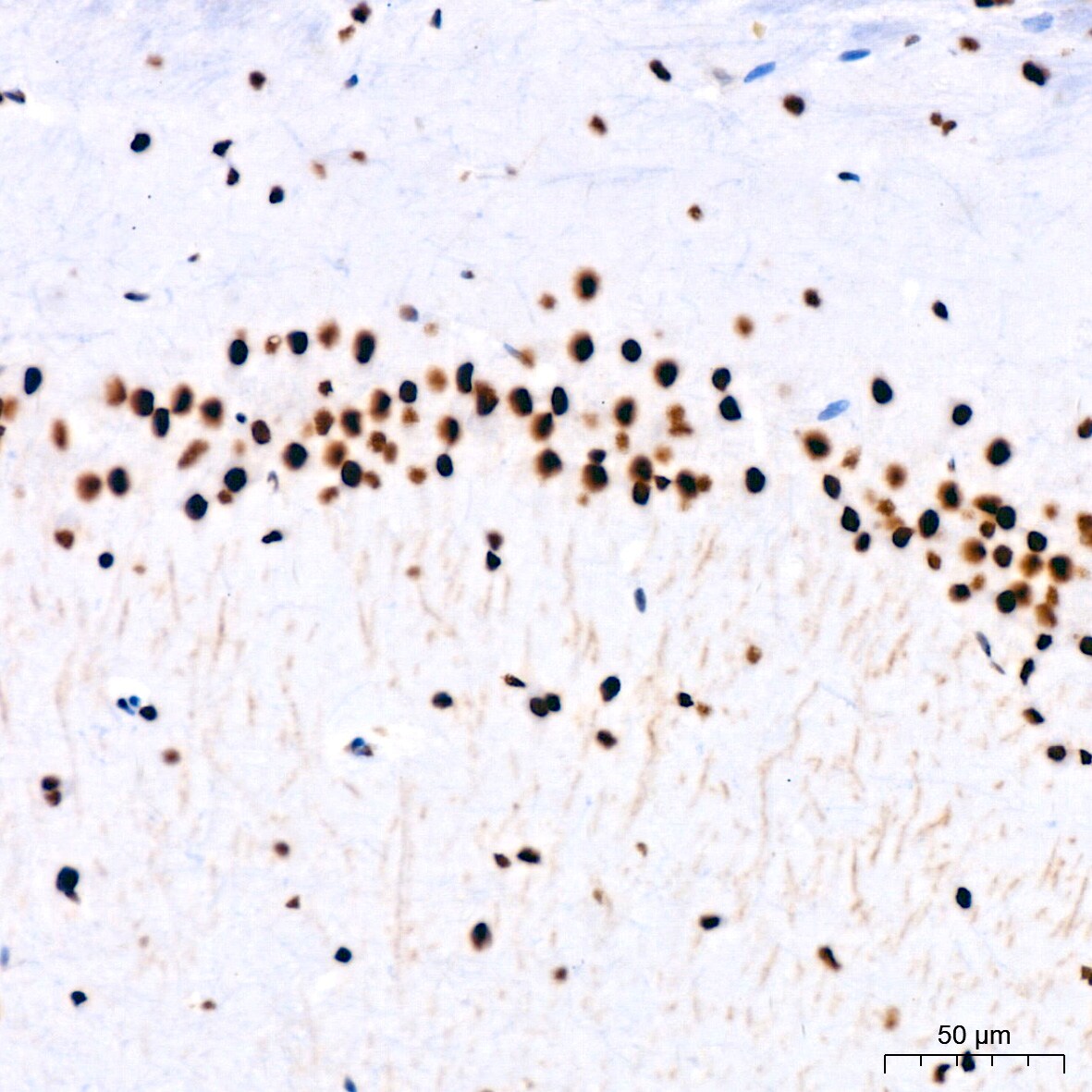 PARP Antibody (2G8N7)