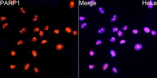 PARP Antibody (2G8N7)