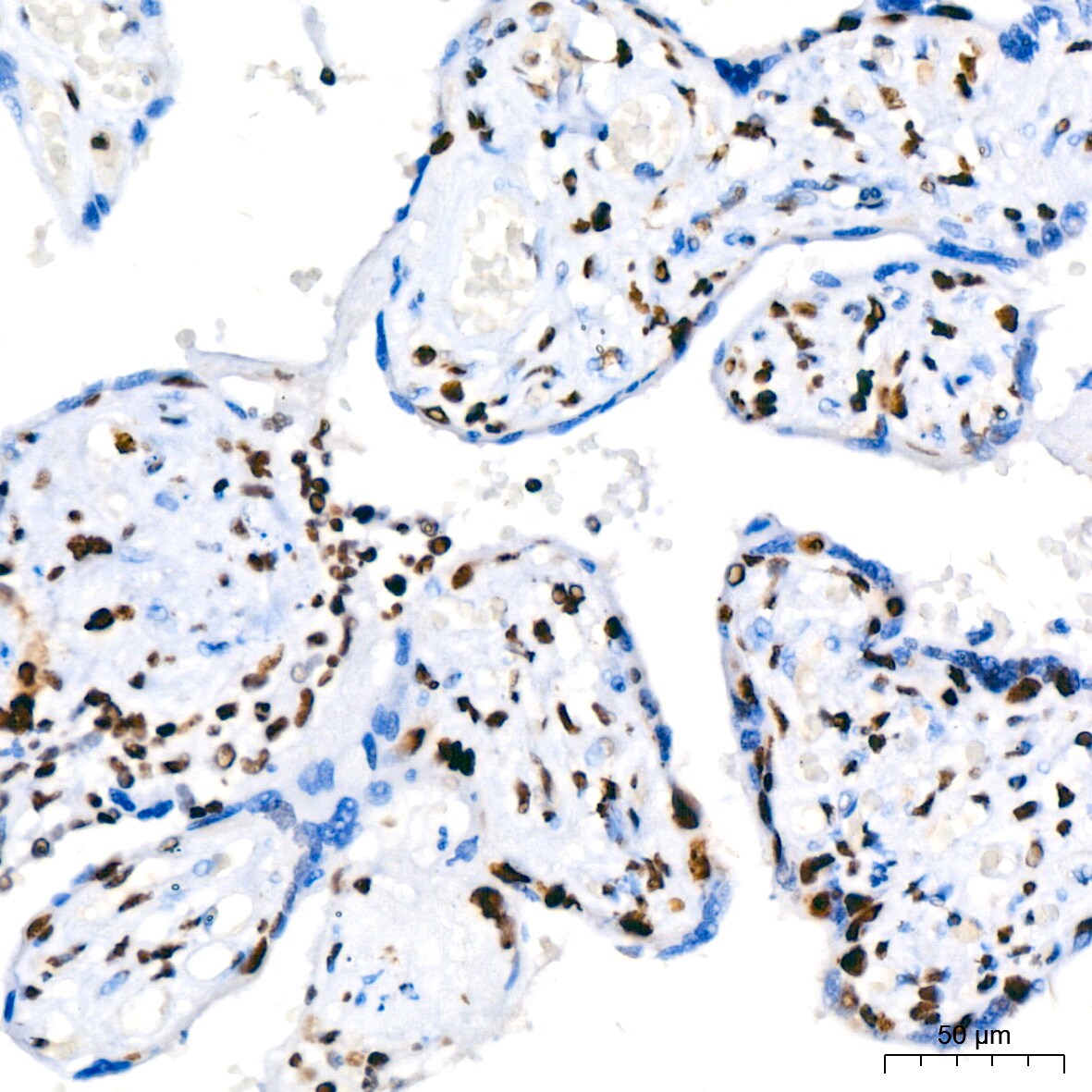 PARP Antibody (2G8N7)