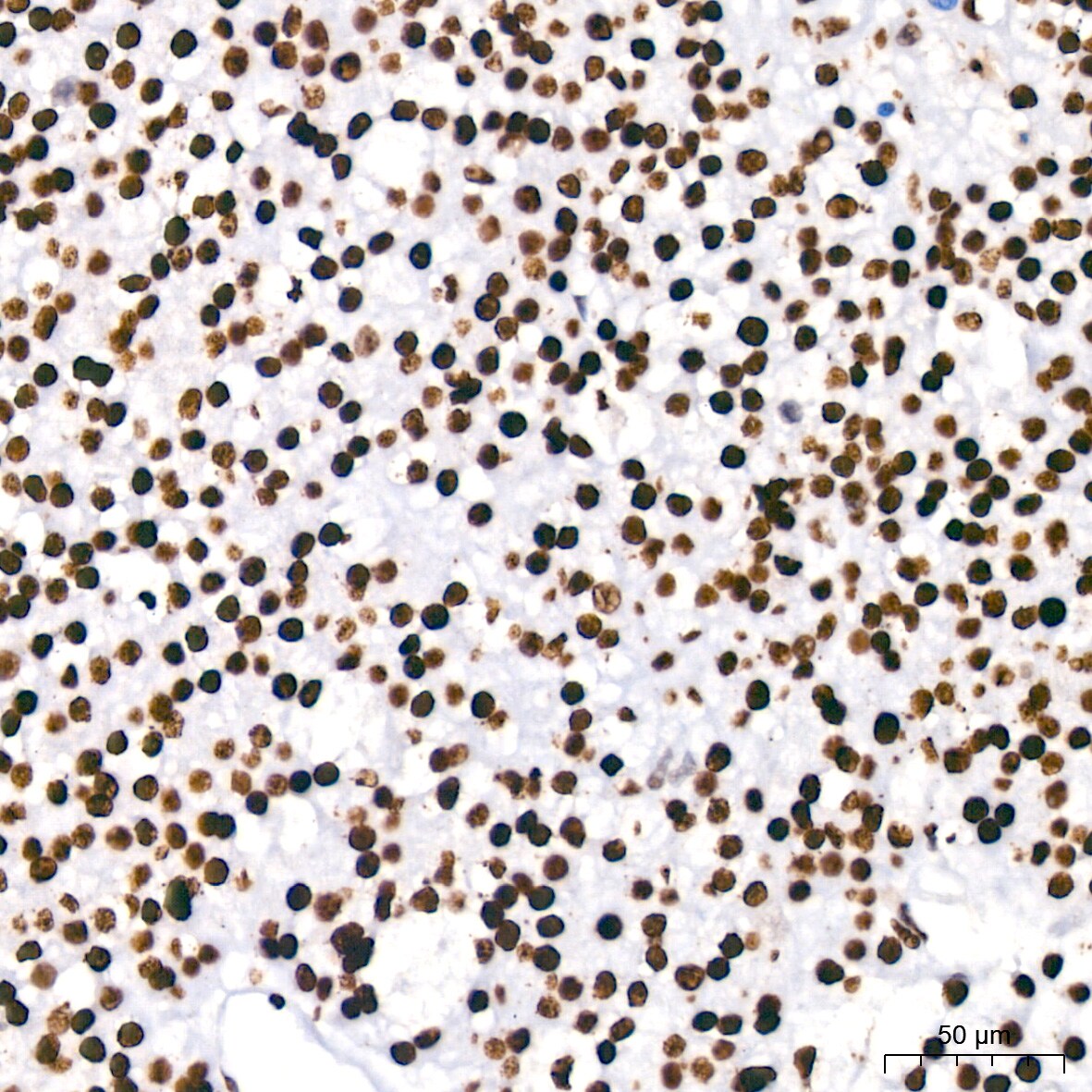 PARP Antibody (2G8N7)