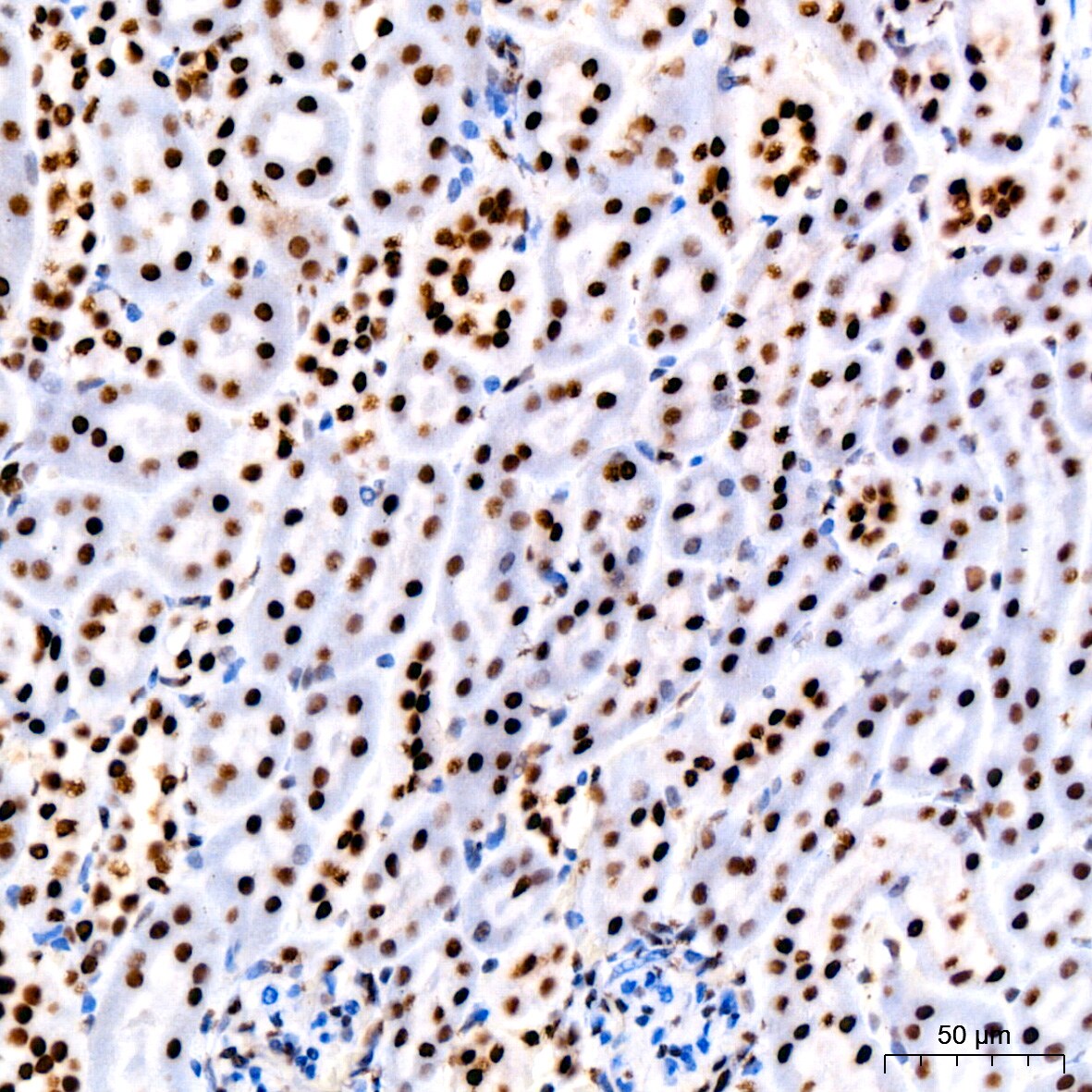 PARP Antibody (2G8N7)