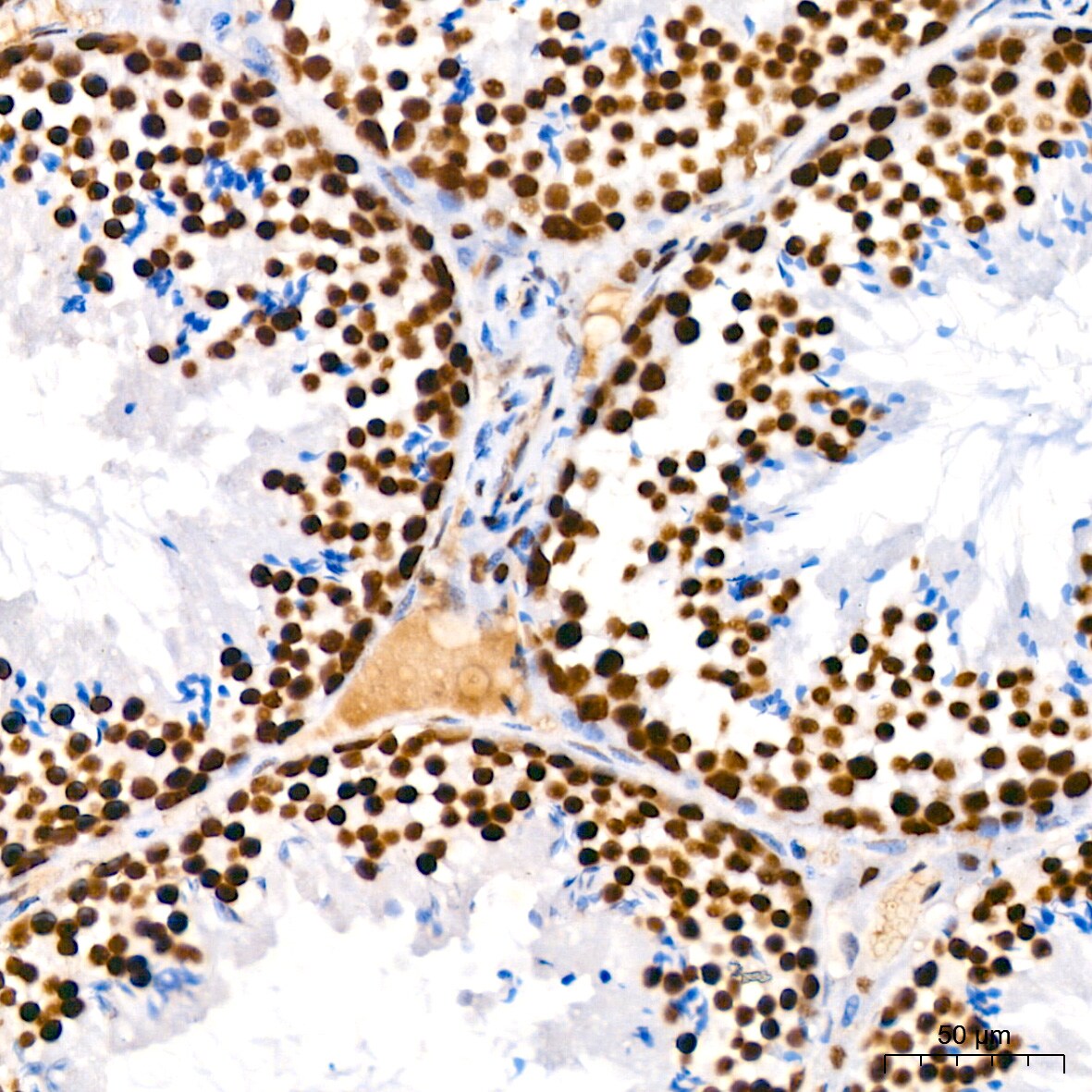 PARP Antibody (2G8N7)