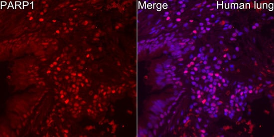 PARP Antibody (2G8N7)