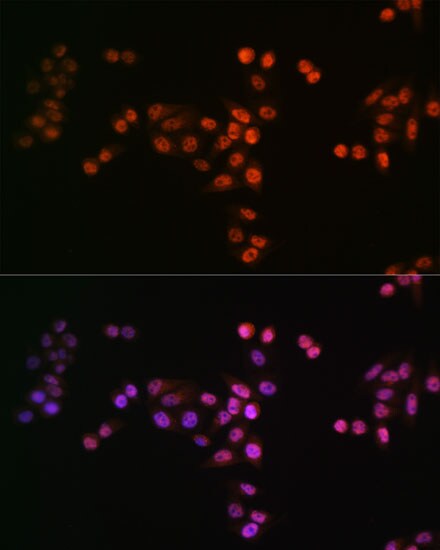 Drosha Antibody (4R0B7)