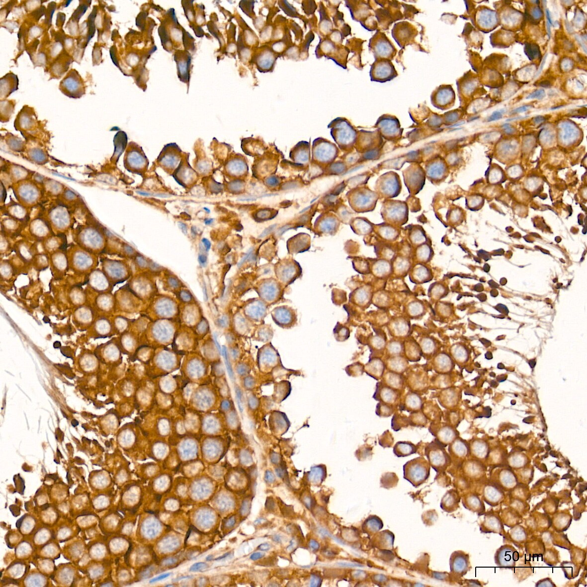 ATG7 Antibody (3X1W4)