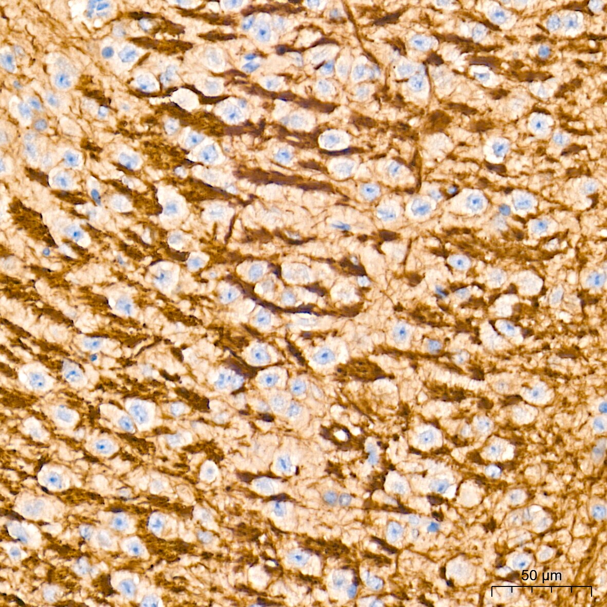 ATG7 Antibody (3X1W4)