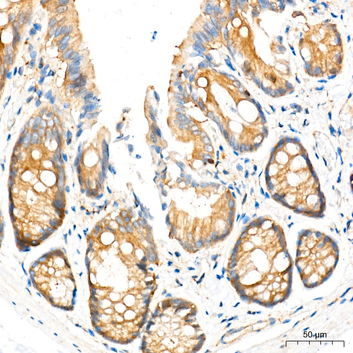 ATG7 Antibody (3X1W4)