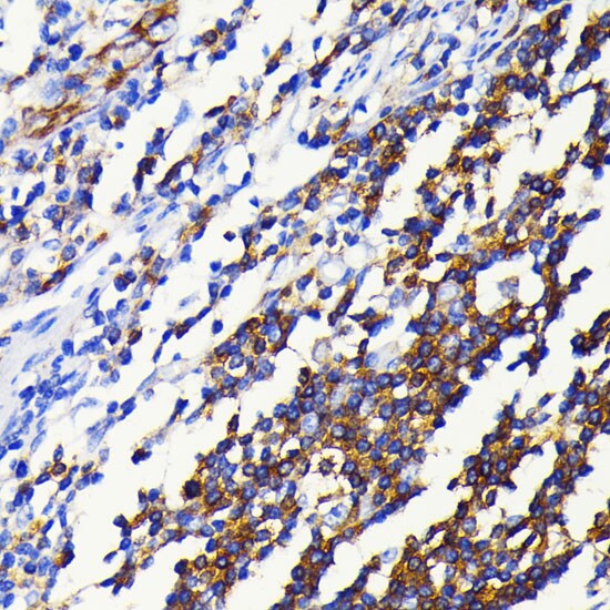NFkB2/NFkB p100 Antibody (4K3V3)