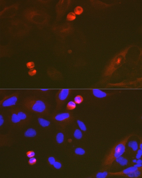 TACC3 Antibody (7S7L2)