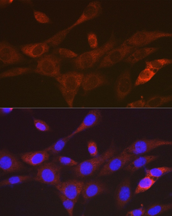 TACC3 Antibody (7S7L2)