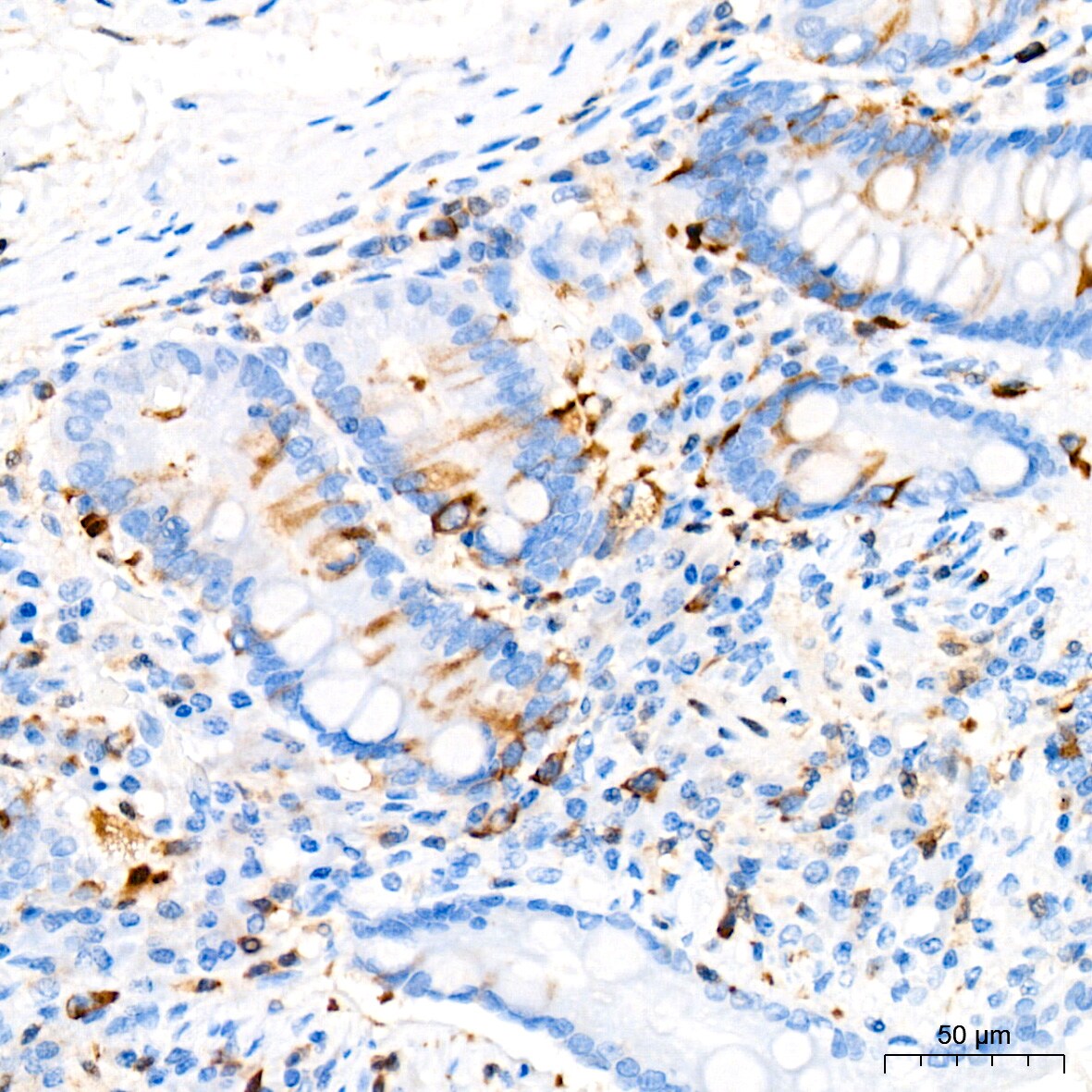 TACC3 Antibody (7S7L2)