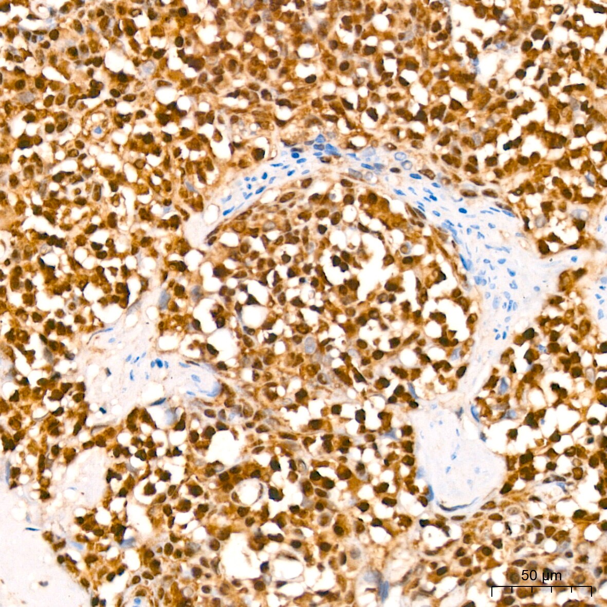 HuR/ELAVL1 Antibody (9Q6L3)