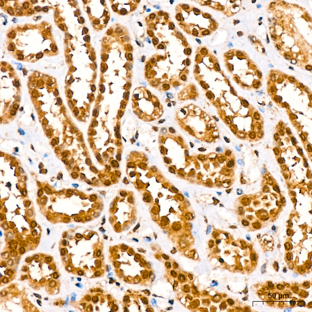 HuR/ELAVL1 Antibody (9Q6L3)