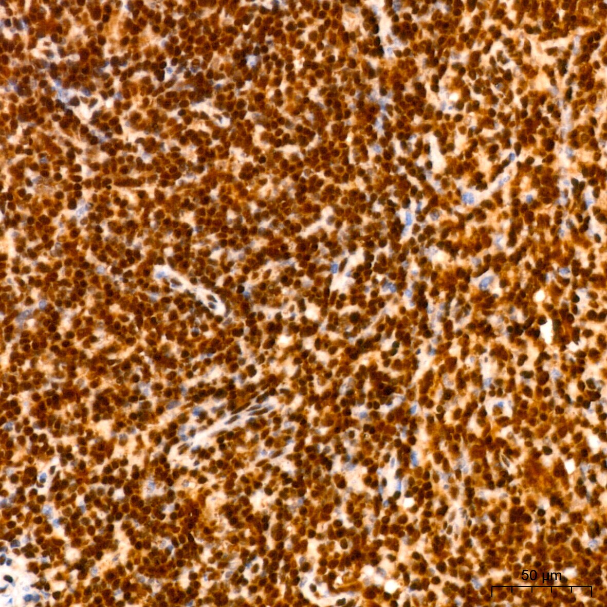 HuR/ELAVL1 Antibody (9Q6L3)