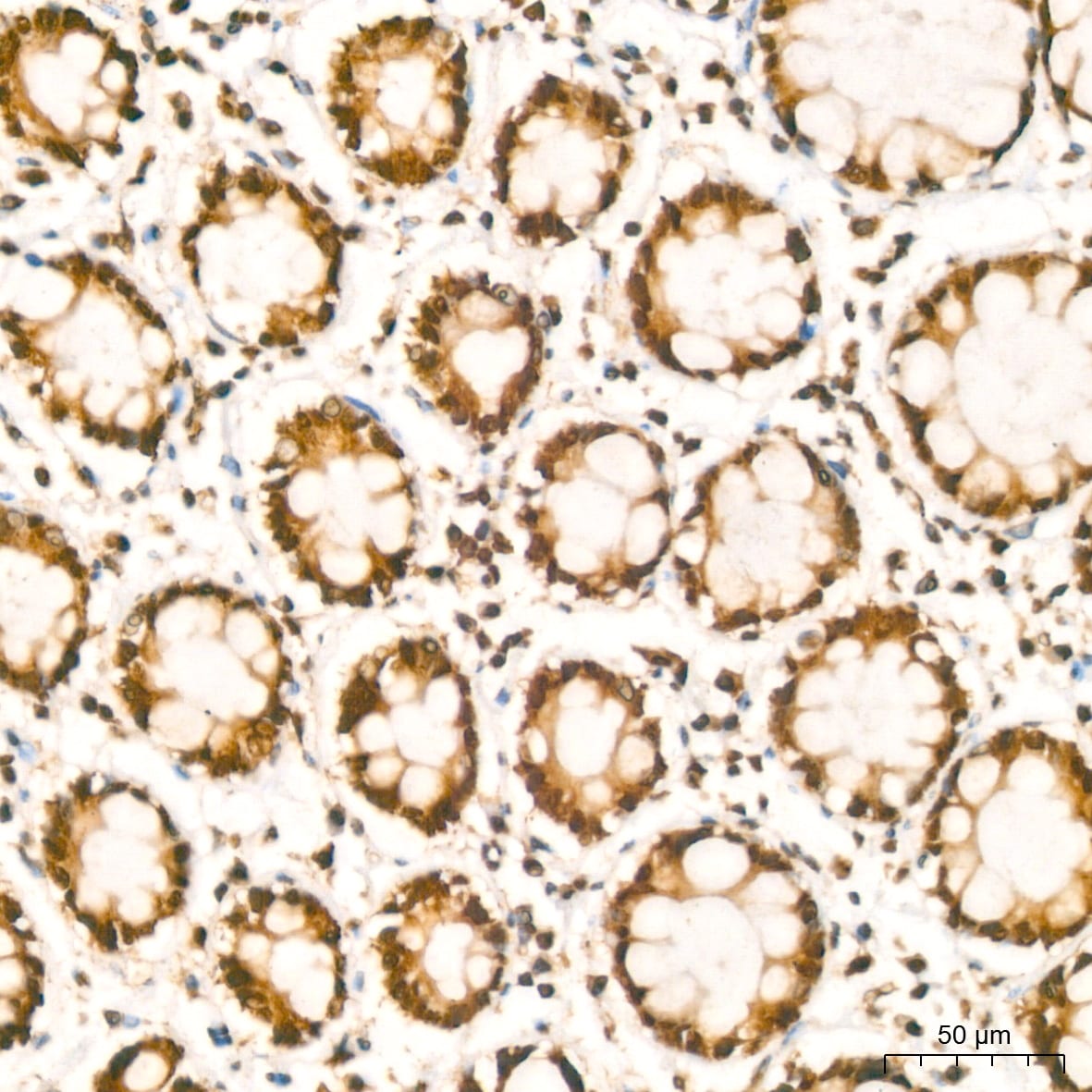 HuR/ELAVL1 Antibody (9Q6L3)
