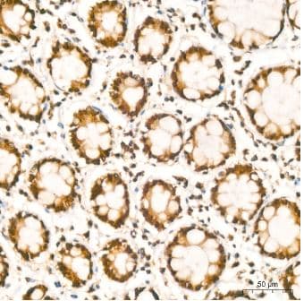 HuR/ELAVL1 Antibody (9Q6L3)