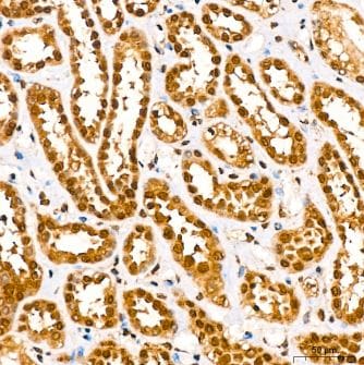 HuR/ELAVL1 Antibody (9Q6L3)