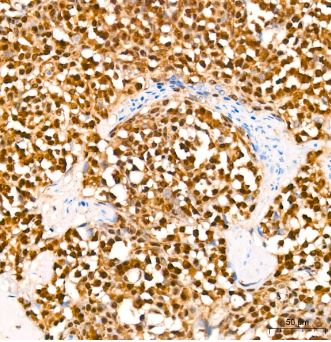 HuR/ELAVL1 Antibody (9Q6L3)