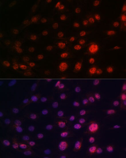 CRM1 Antibody (1J0L10)