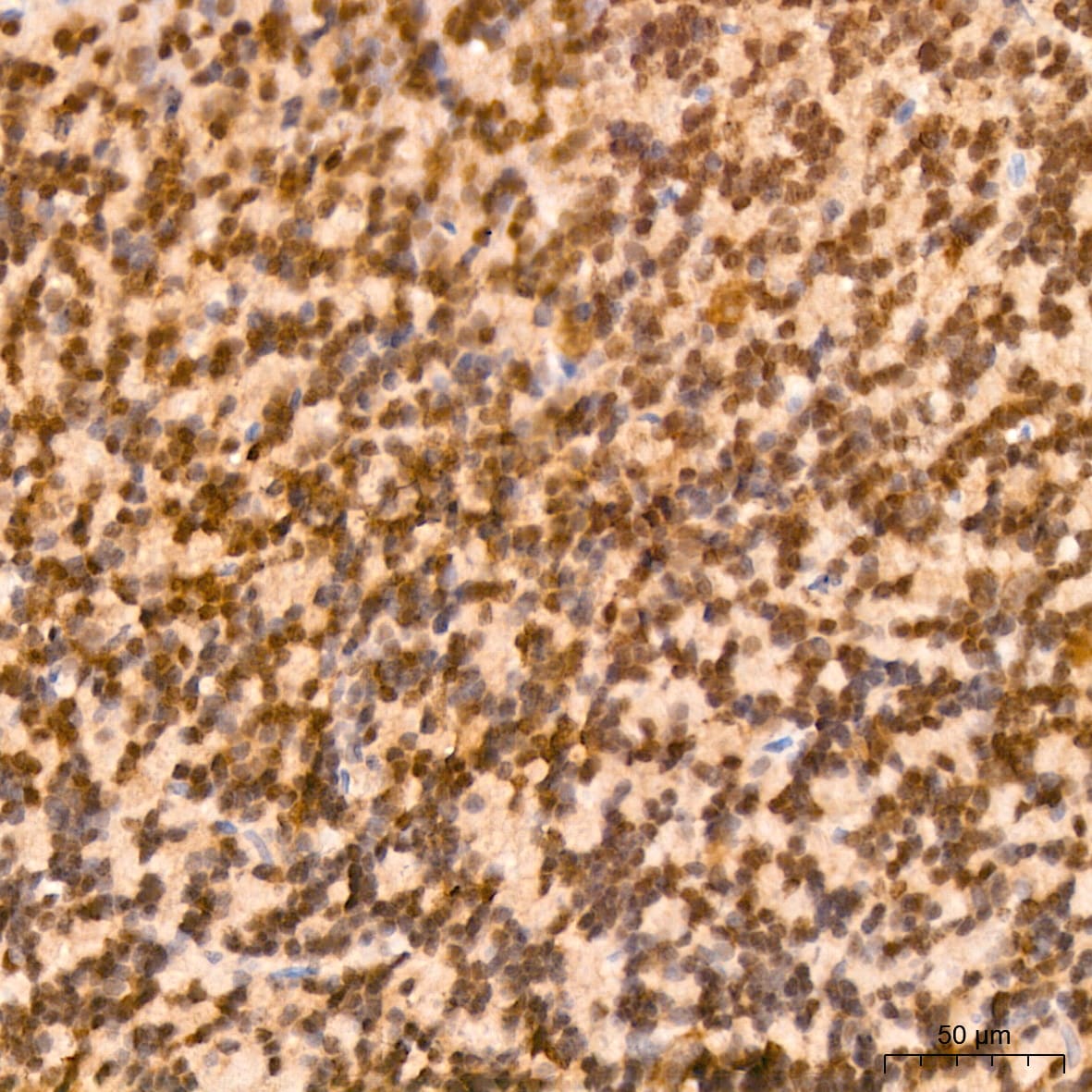 ERK2 Antibody (2K9N9)