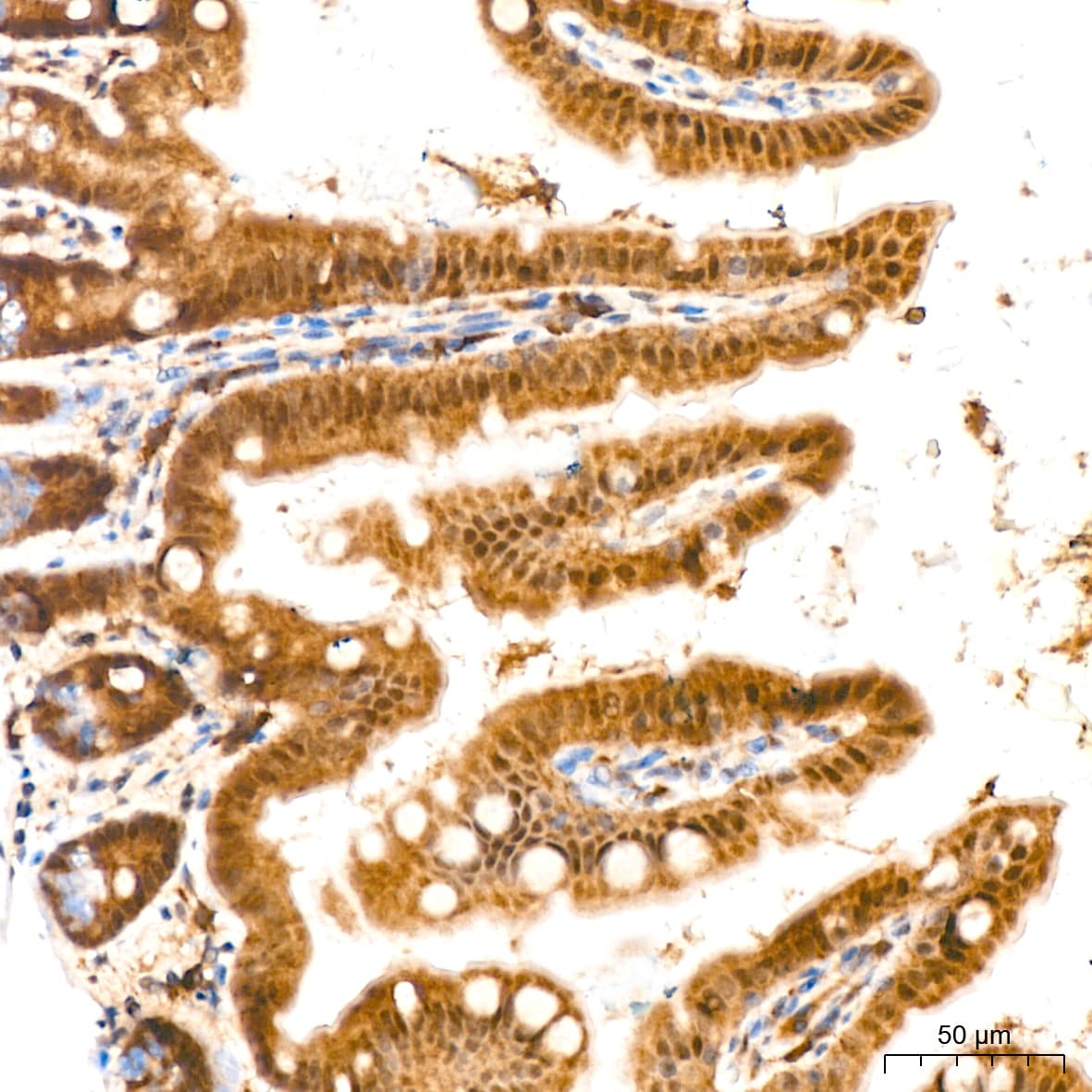 ERK2 Antibody (2K9N9)