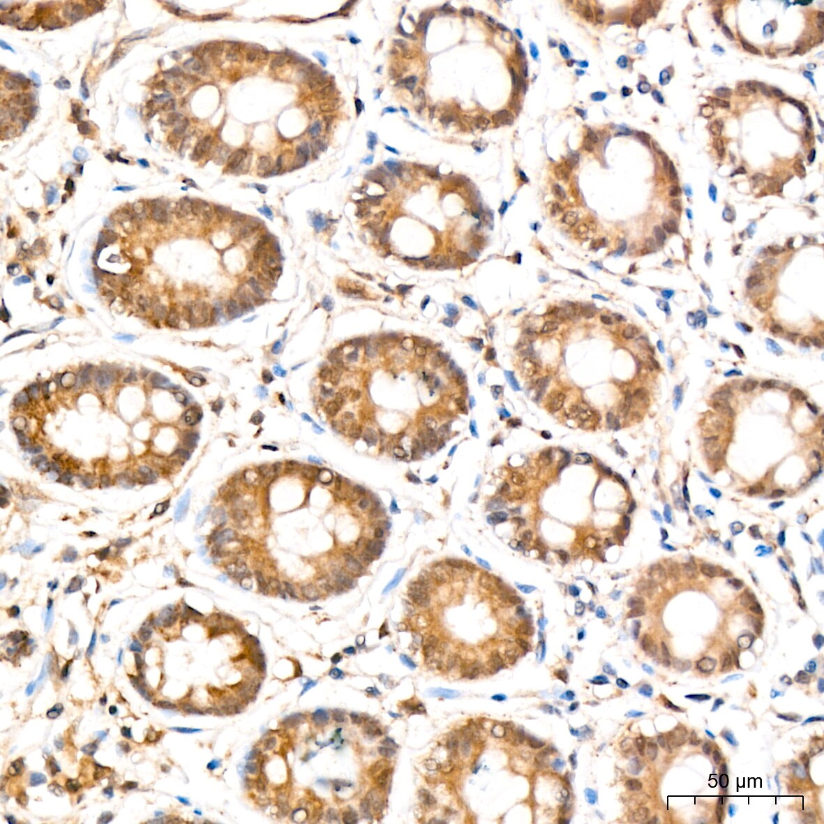 ERK2 Antibody (2K9N9)