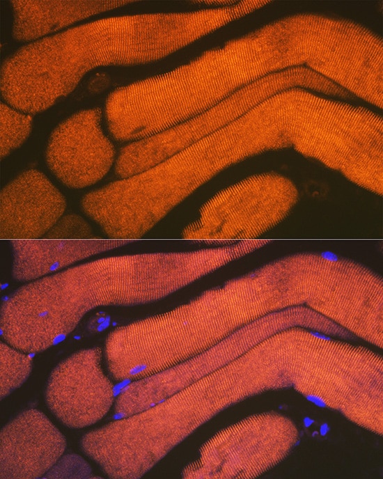Alpha Actinin 3 Antibody (4H7E6)
