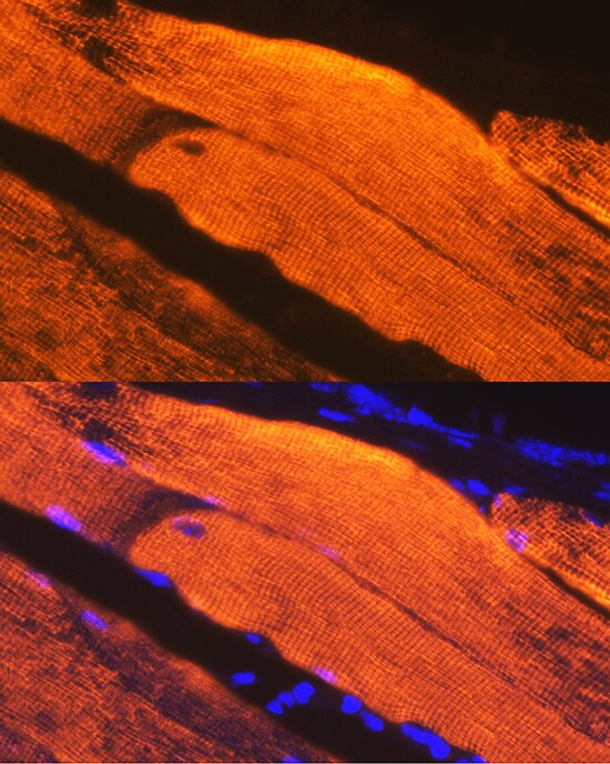 Calsequestrin 1 Antibody (5P6U2)