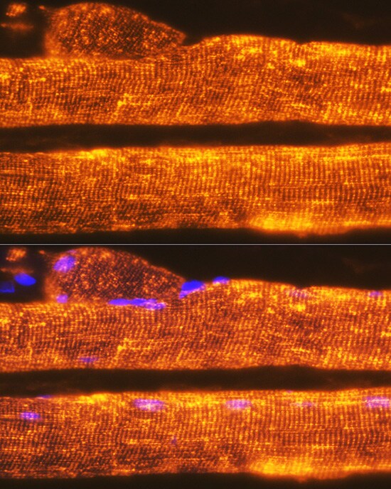 Calsequestrin 1 Antibody (5P6U2)