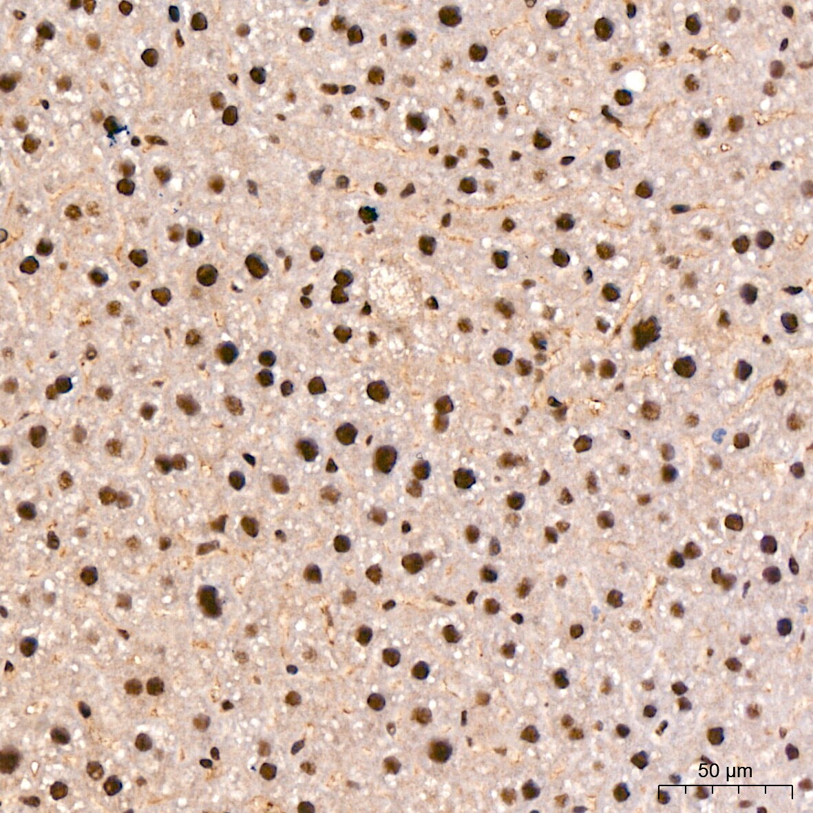 SP1 Antibody (5I3A8)