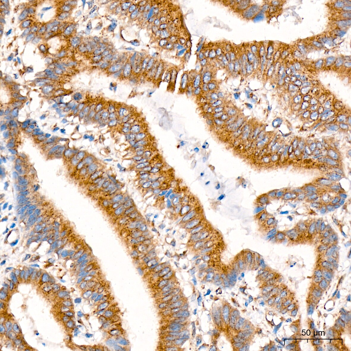 alpha COP I Antibody (3W6Y6)