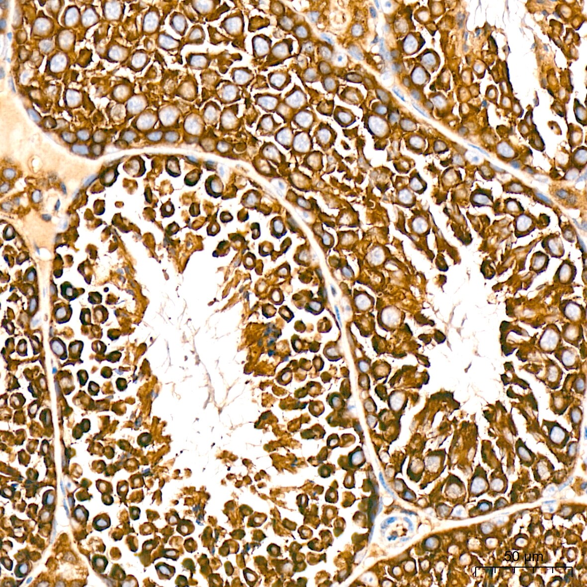 alpha COP I Antibody (3W6Y6)