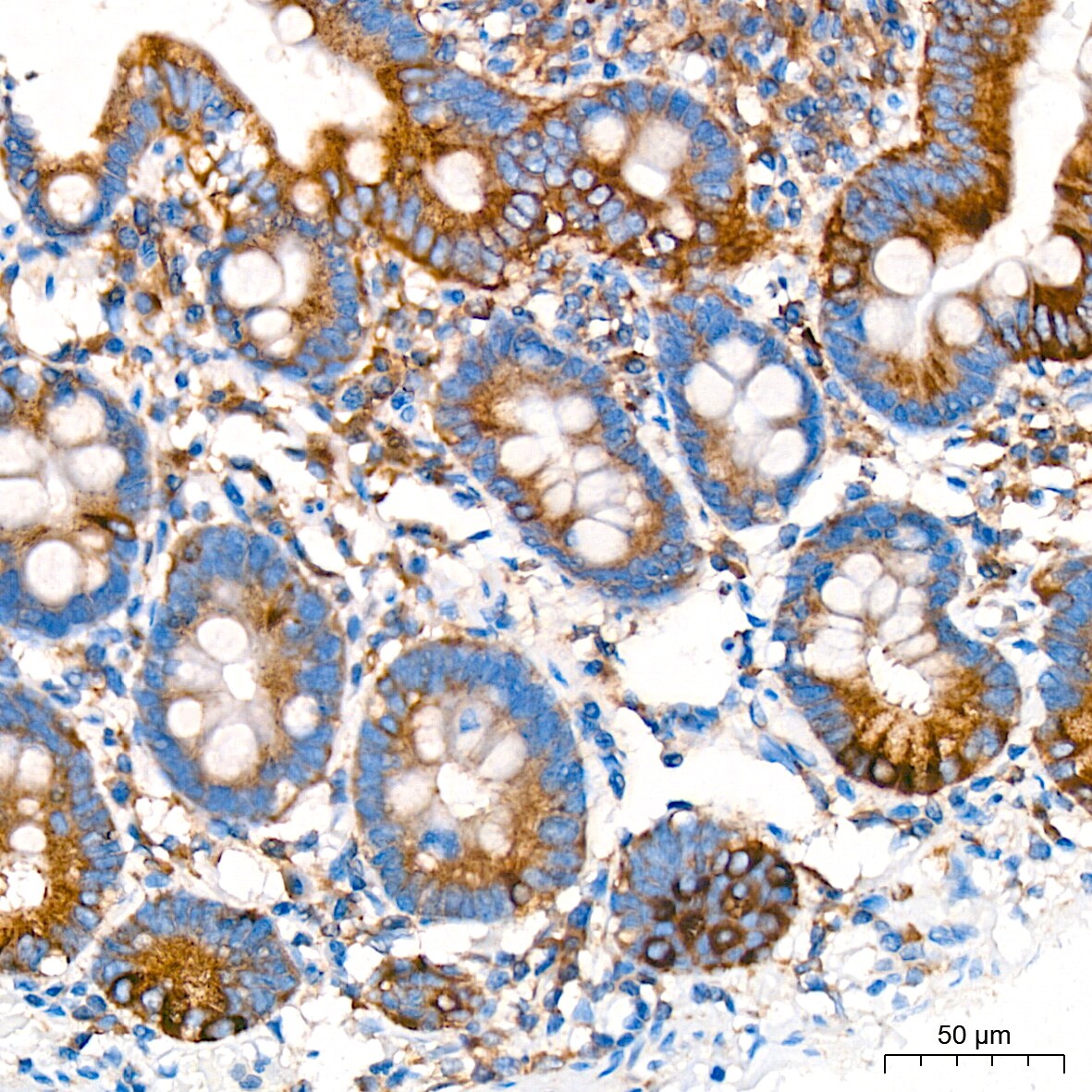 alpha COP I Antibody (3W6Y6)