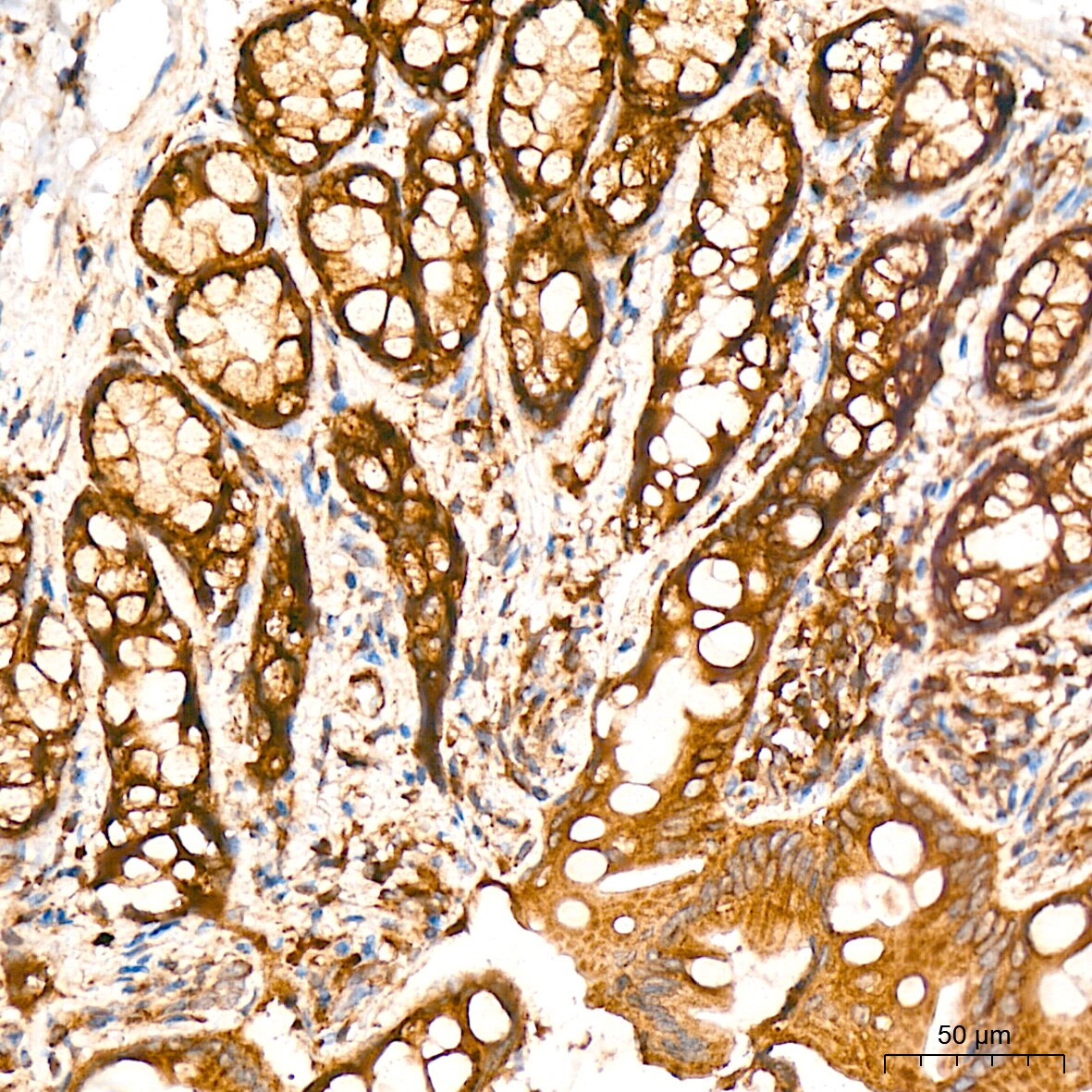 alpha COP I Antibody (3W6Y6)