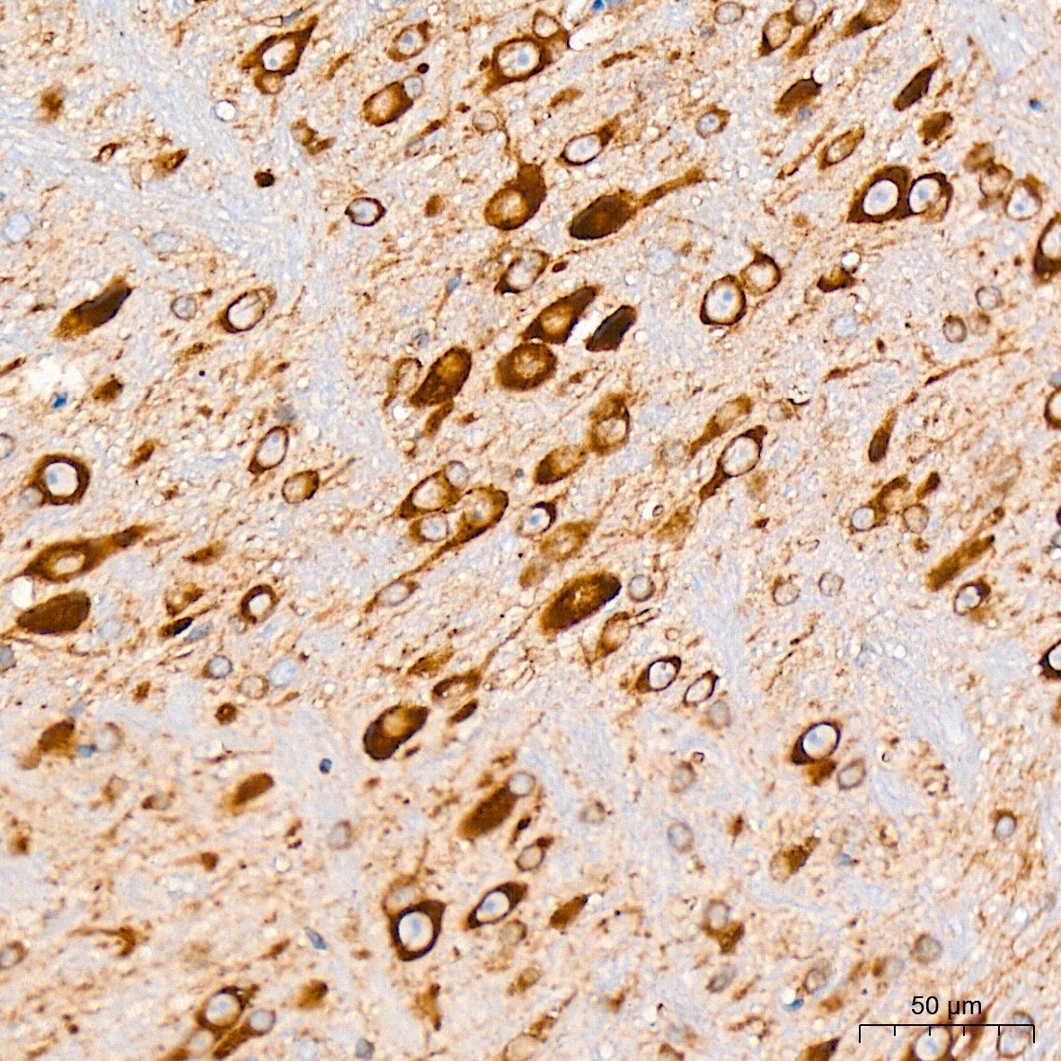 alpha COP I Antibody (3W6Y6)