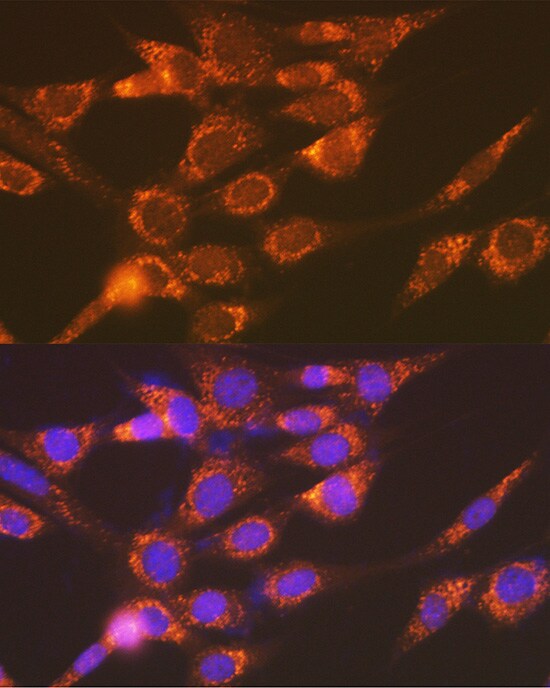 Versican Antibody (6D8K9)