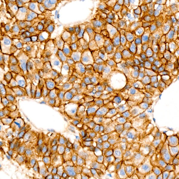 beta-Catenin Antibody (6A3P2)