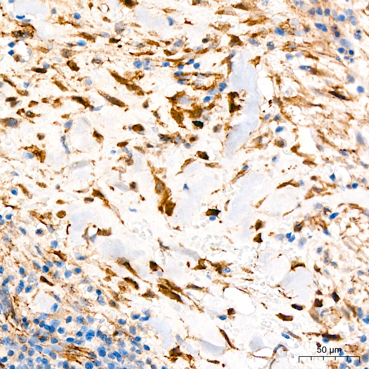 beta-Catenin Antibody (6A3P2)