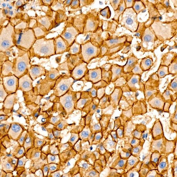 beta-Catenin Antibody (6A3P2)