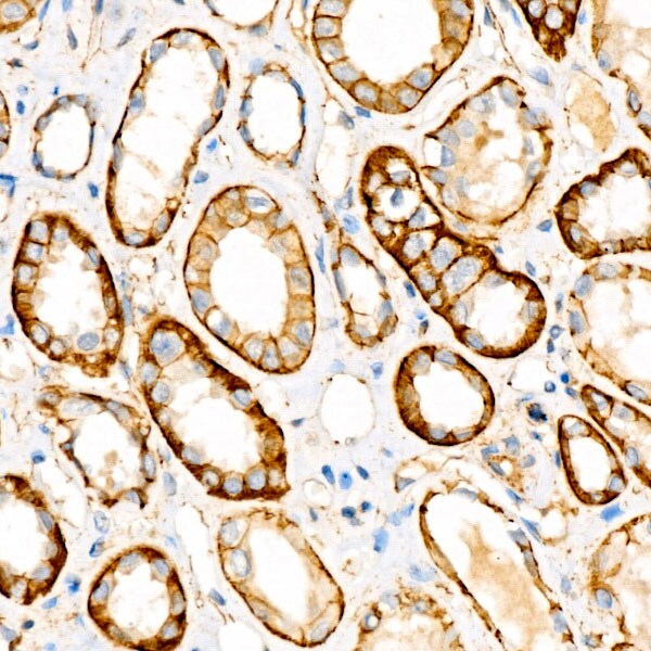 beta-Catenin Antibody (6A3P2)
