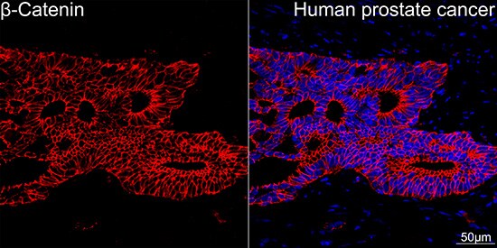 beta-Catenin Antibody (6A3P2)