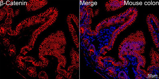 beta-Catenin Antibody (6A3P2)