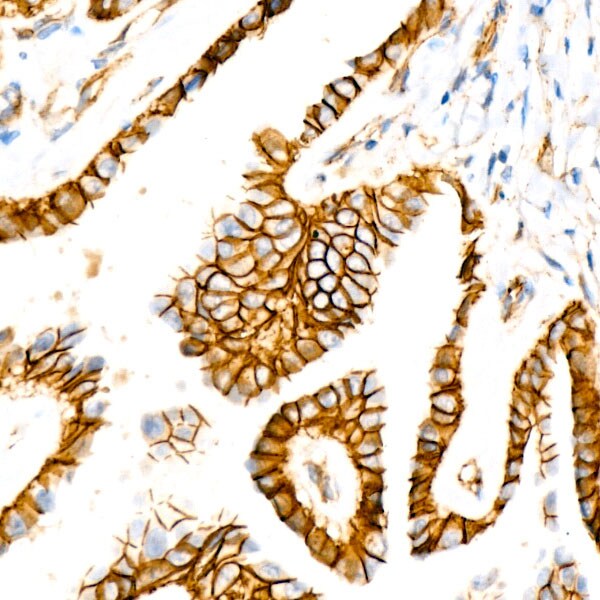 beta-Catenin Antibody (6A3P2)