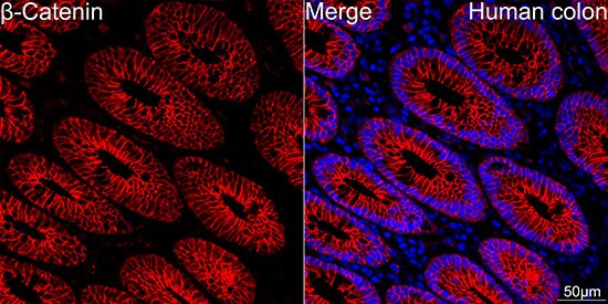 beta-Catenin Antibody (6A3P2)