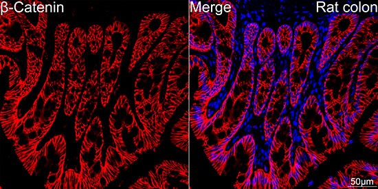 beta-Catenin Antibody (6A3P2)