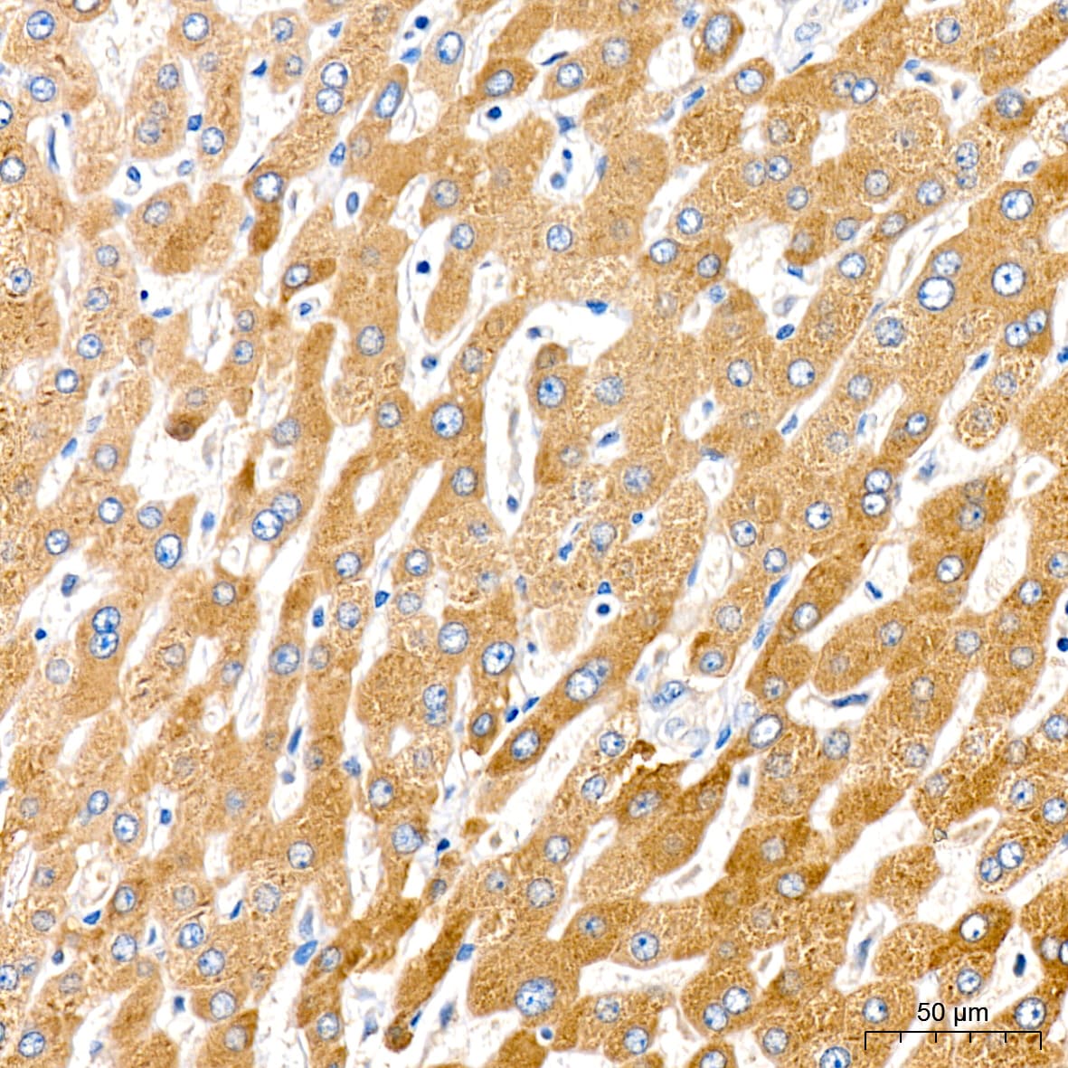 Cytochrome P450 4A Antibody (10D10W7)