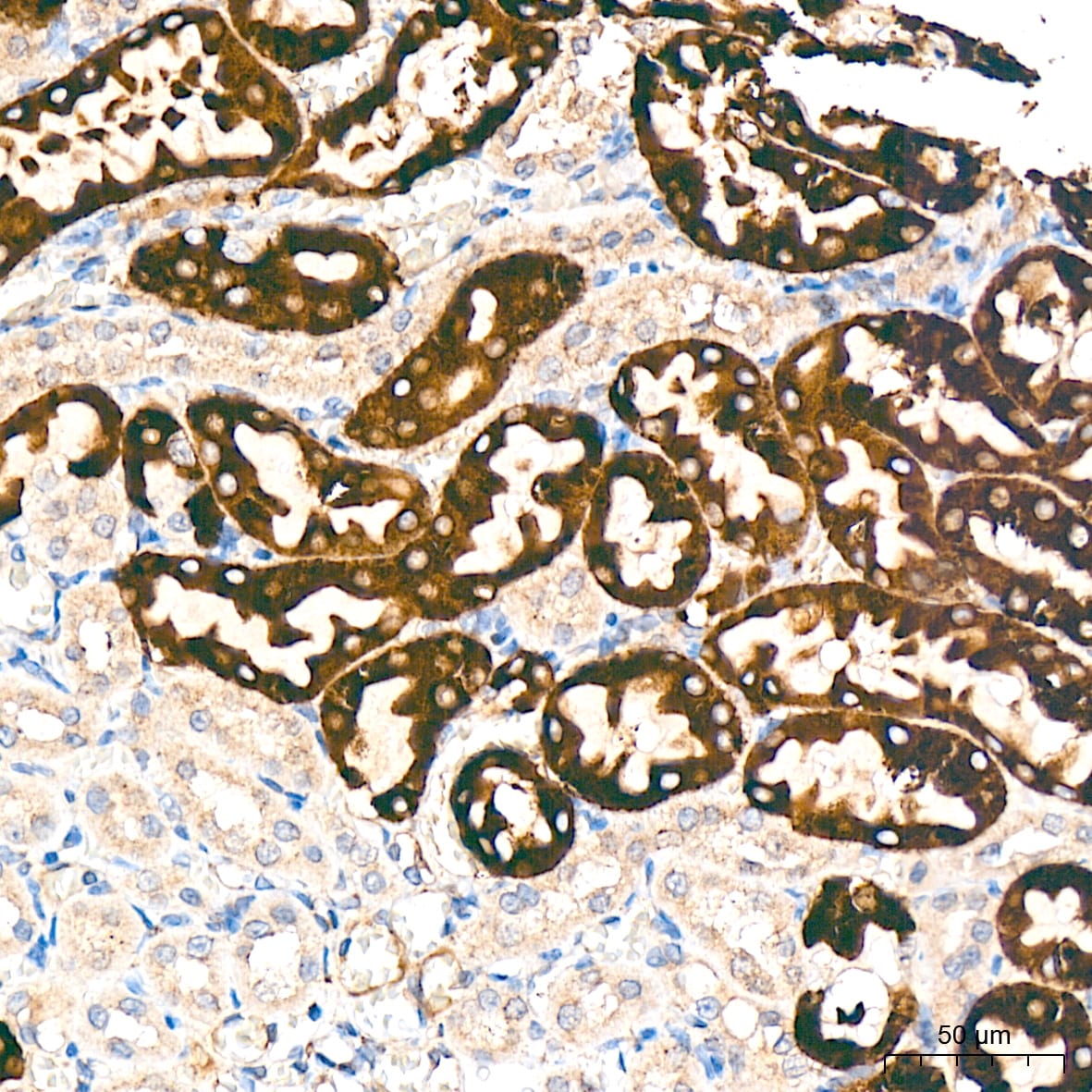 Cytochrome P450 4A Antibody (10D10W7)
